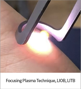 Focusing Plasma Technique, LIOB, LITB